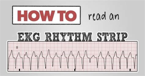 How to Read an EKG Rhythm Strip | Health And Willness