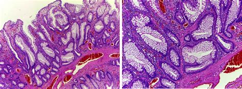 GASTROINTESTINAL AND LIVER HISTOLOGY PATHOLOGY ATLAS: COLON ...