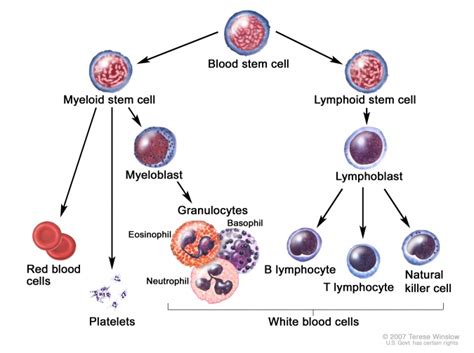 Acute Lymphoblastic Leukaemia Physiopedia