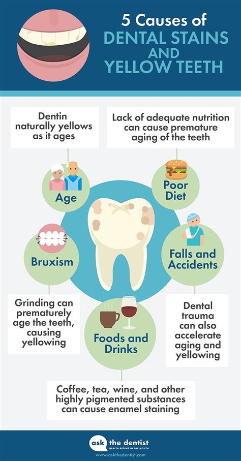 Teeth Whitening at Home: 9 Ways to Whiten Teeth & Prevent Future Stains