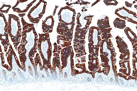 Immunohistochemical Staining Libre Pathology