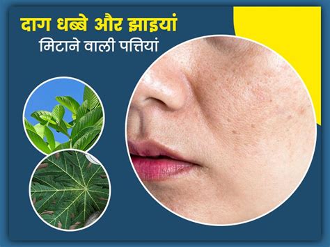 चेहरे पर दाग धब्बे और झाइयां मिटाने के लिए इस्तेमाल करें ये 5 पत्तियां Best Leaves For Skin