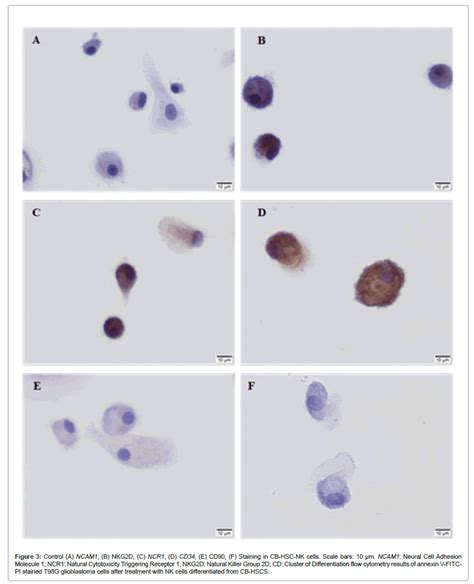 Journal Of Oncology Research And Treatment Anti Tumoral Effects Of