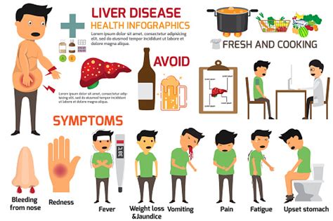 Liver Disease Vector Infographics Sign And Symptoms Of Liver Disease Vector Illustration Stock