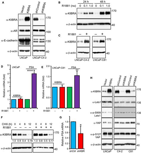 Kibra Promotes Prostate Cancer Cell Proliferation And Motility