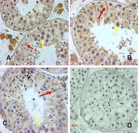 Representative Light Micrographs Showing Immunostaining Of Igfbp3 On