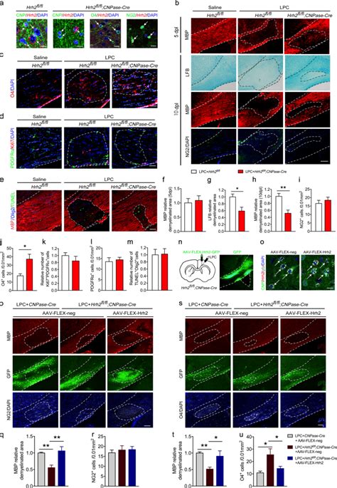 Selective Deletion Of H R In Differentiating Ols Promotes Ol