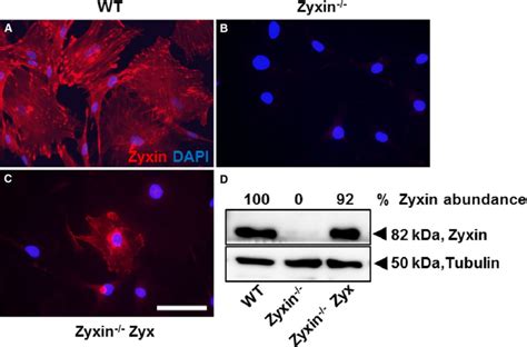 Transient Reexpression Of Zyxin In Zyxin VSMCs A Confocal