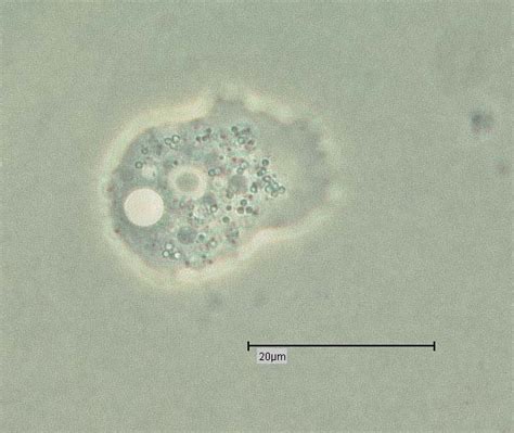 Adherent Trophozoite Of Acanthamoeba Sp Light Microscopy Phase Download Scientific Diagram