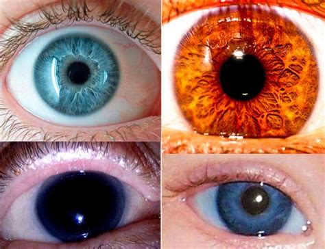 Los Colores De Ojos Más Raros En Los Seres Humanos Contexto Tucuman