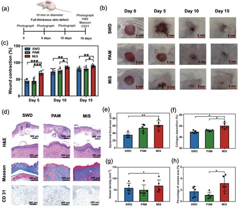 Healing Of Murine Fullthickness Skin Defect Wound With The Mis A