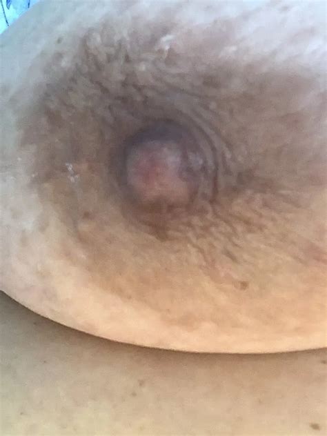 Anatomy Of A Big Brown Bbw Nipple Close Up And Natural 6 Nude Pics XHamster