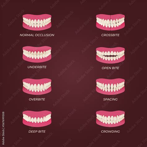 Medical Dental Diagram Illustration Orthodontist Human Tooth Anatomy