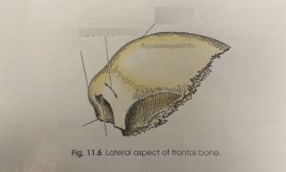 lateral frontal bone diagram quizlet