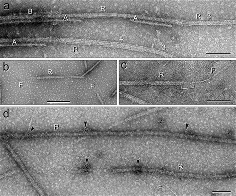 negative stain em  immuno em  dmt ribbon  filament fractions
