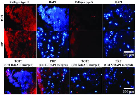 Expressions Of Collagen Ii And X In Chondrogenically Differentiated Download Scientific Diagram