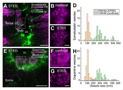 Somatostatin And Dopamine In Cerebrospinal Fluid Contacting Csf C