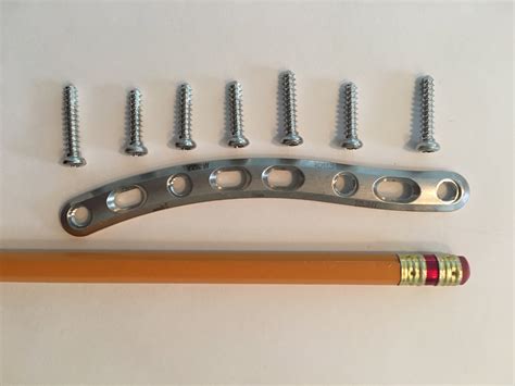 Clavicle Hardware REMOVAL PART 3: CollarBone Fracture – removing the