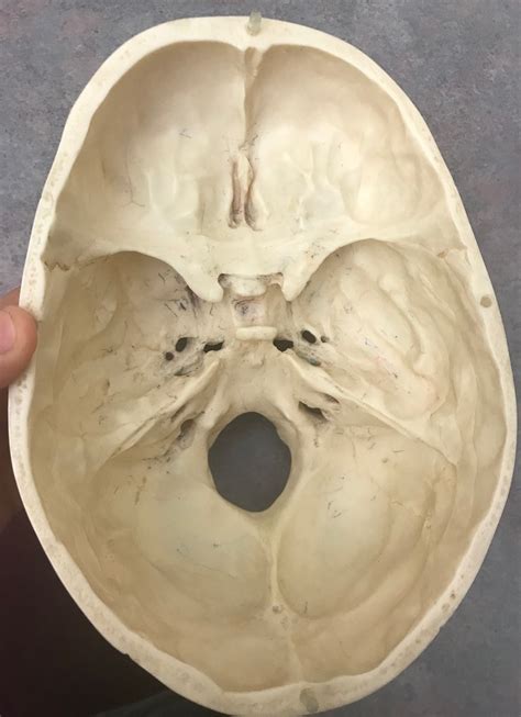 Skull Pt Diagram Quizlet