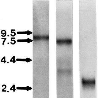 Northern Blot Analysis Of Hgf Sf C Met And Tpa Mrna Expression In