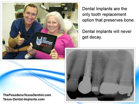 Missing Teeth Deer Park Pasadena Texas Dental Implants