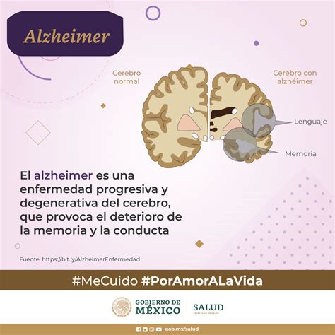 Enfermedad De Alzheimer Demencia Más Común Que Afecta A Personas Adultas Mayores Secretaría