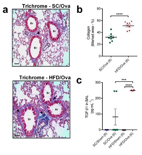 Lung Collagen Deposition And Tgf Level In Mice Born To Hfd Fed