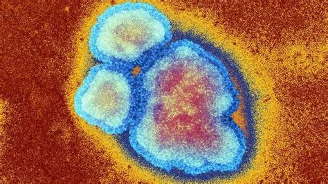 Measles Must Be Tackled With Jab To Prevent Another Outbreak Bbc News