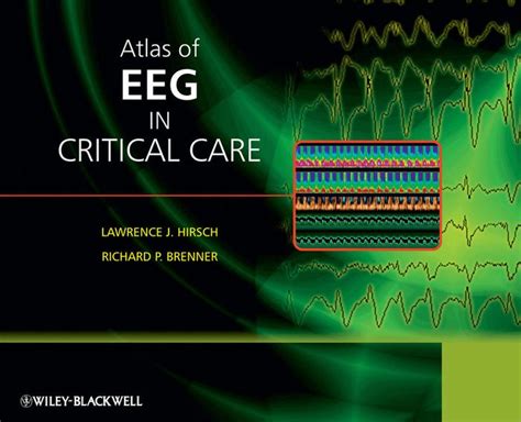 Atlas Of Eeg In Critical Care By Lawrence J Hirsch Ebook Barnes