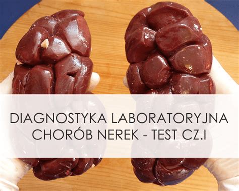 Diagnostyka laboratoryjna chorób nerek test cz I Okiem Diagnosty