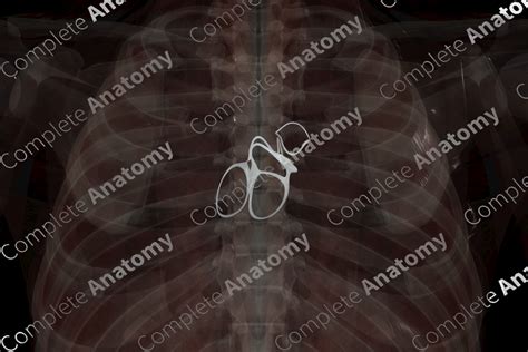 Fibrous Skeleton of Heart | Complete Anatomy