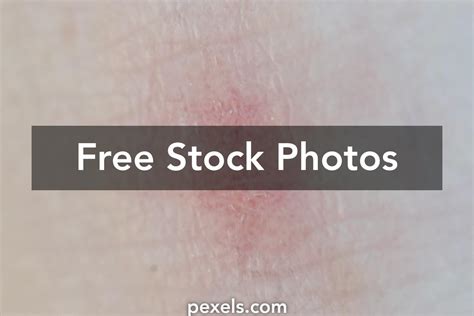 Textures Scar Photos, Download The BEST Free Textures Scar Stock Photos ...