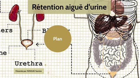 R Tention Aigu D Urine By Yasmine Mimouni On Prezi