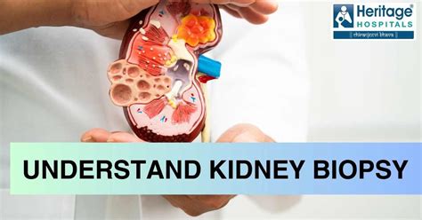 What Is A Kidney Biopsy? Purpose, Types, Risks & Procedure