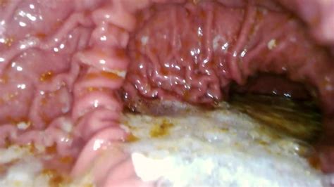 POV Inside Of A Gay Mans Stomach ThisVid