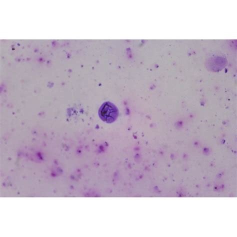 Leishmania Donovani Promastigotes Smear Agent Of Visceral