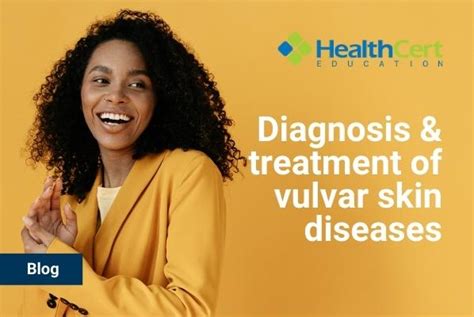 Diagnosis And Treatment Of Vulvar Skin Diseases