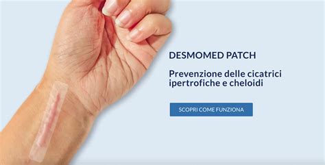 Trattamento Cicatrici Desmomed