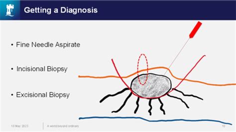 Oncology Flashcards Quizlet