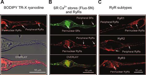 Localization Of Ryrs In Pulmonary Arterial Smooth Muscle Cells