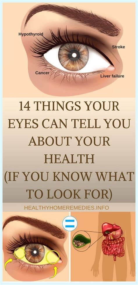 14 Things Your Eyes Are Trying To Tell You About Your Health Artofit