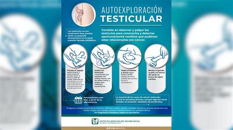 IMSS de SLP exhortó a hombres a autoexplorarse para prevenir cáncer