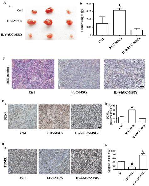 Role Of Il Human Umbilical Cord Derived Mesenchymal Stem Cells