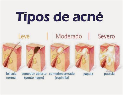 ADELMED Nutrición y Medicina Estética abril 2014