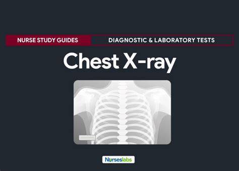 Chest X Ray Chest Radiography Nursing Responsibilities Nurseslabs