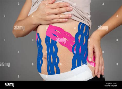 Anti Cellulite Procedure For Slim Belly Close Up Of Kinesiology Tape