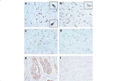 Immunohistochemical Staining For β Catenin And Non Phospho Download Scientific Diagram