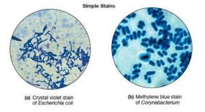 Different Staining Methods used in Microbiology - Microbiology Notes