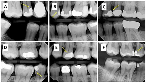 Applied Sciences Free Full Text Prevalence And Characteristics Of