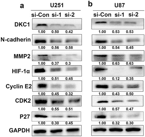 Knockdown Of Dkc1 Inhibits Glioma Cell Migration A Representative Download Scientific Diagram